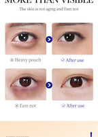 Collagen Roll-On Eye Cream for Dark Circles and Puffiness