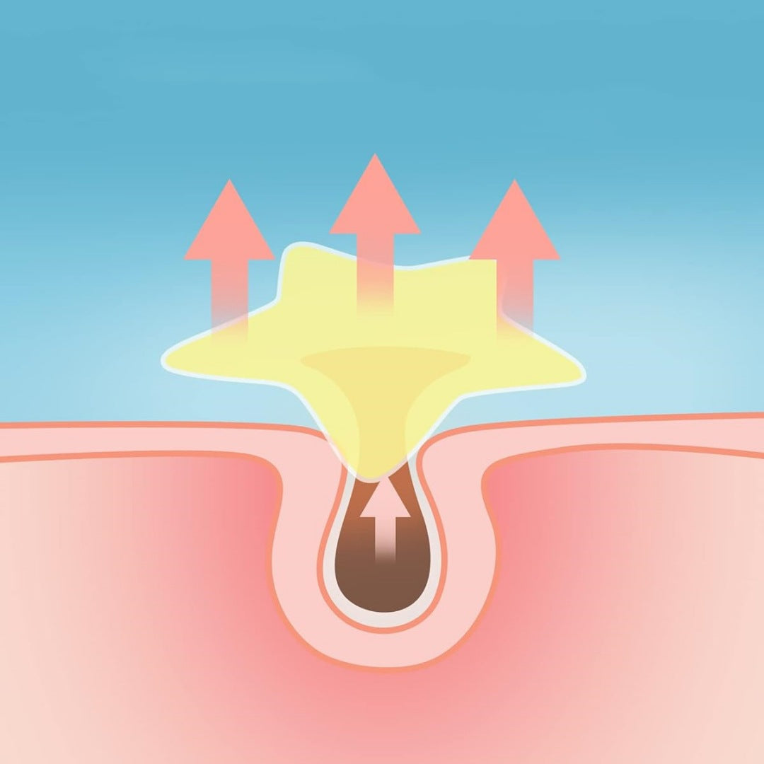 Star-Shaped Hydrocolloid Acne Patches for Fast Blemish Healing