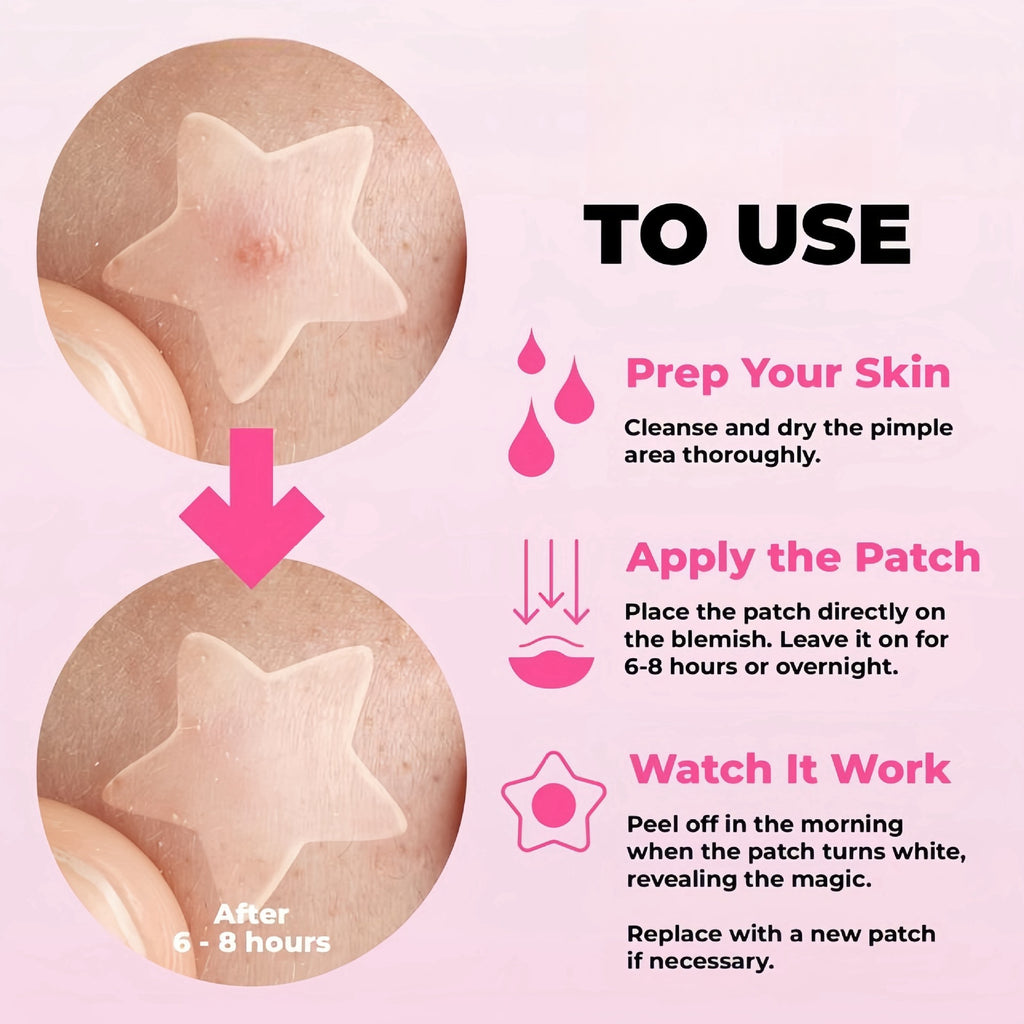 Star-Shaped Hydrocolloid Acne Patches for Fast Blemish Healing