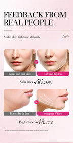 V-Shape Face Lifting Hydrogel Mask for Jawline Firming