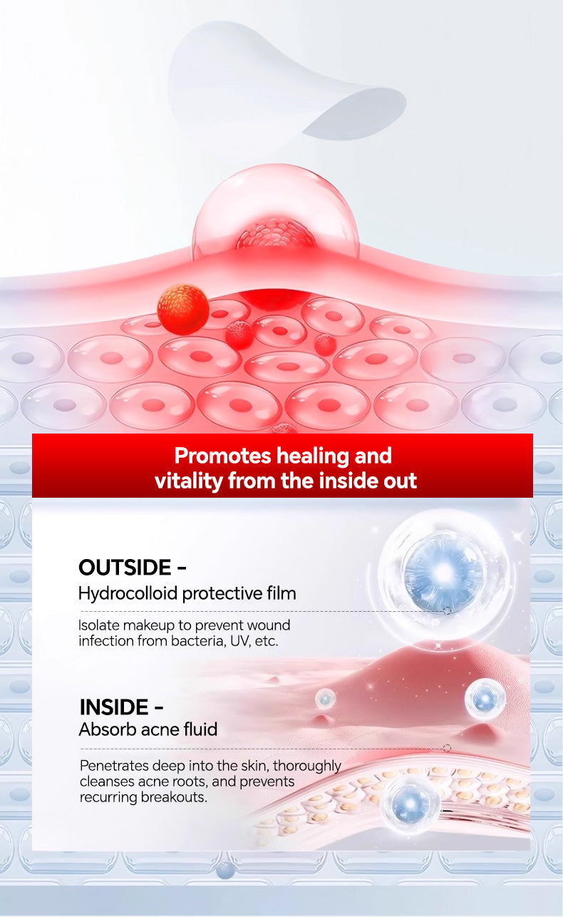 Star-Shaped Hydrocolloid Acne Patches for Clear Skin - 10