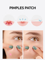 Star-Shaped Hydrocolloid Acne Patches for Clear Skin