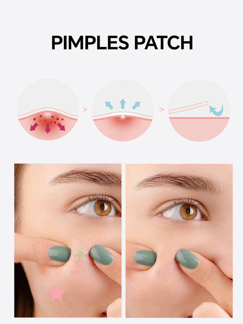 Star-Shaped Hydrocolloid Acne Patches for Clear Skin