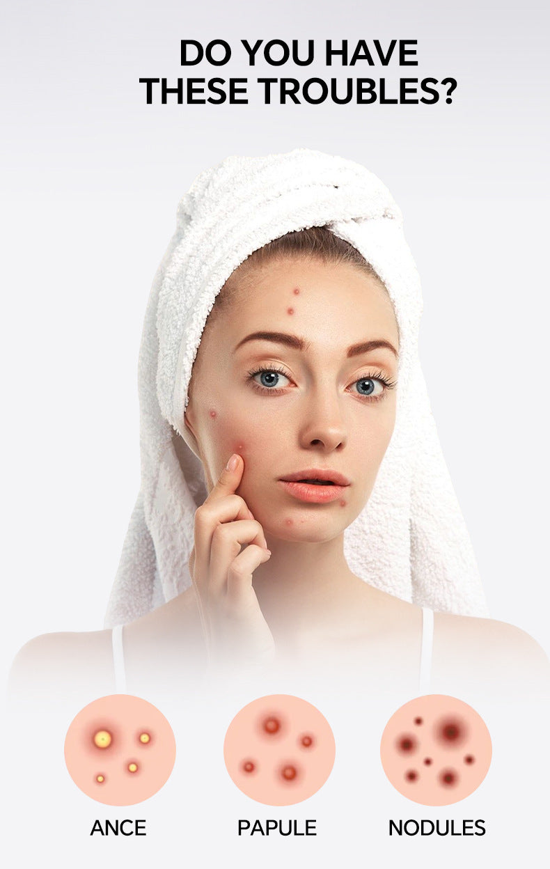 Star-Shaped Hydrocolloid Acne Patches for Clear Skin