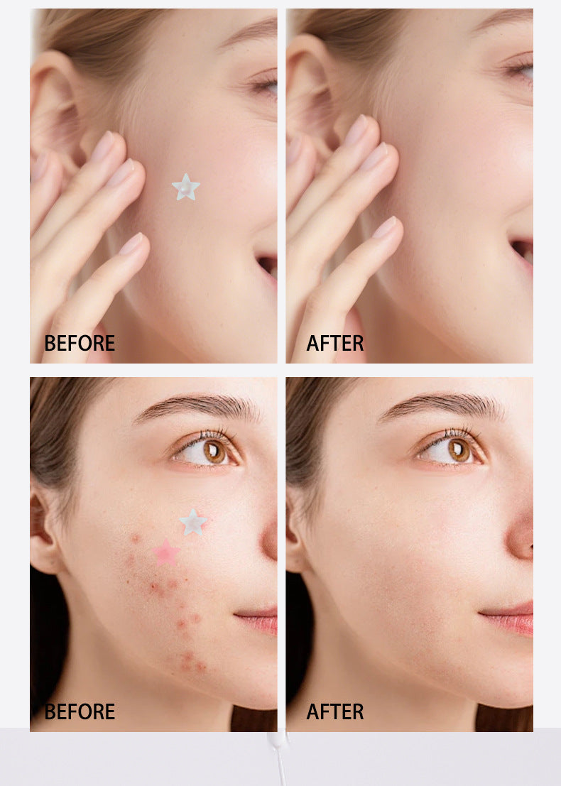 Star-Shaped Hydrocolloid Acne Patches for Clear Skin - 14
