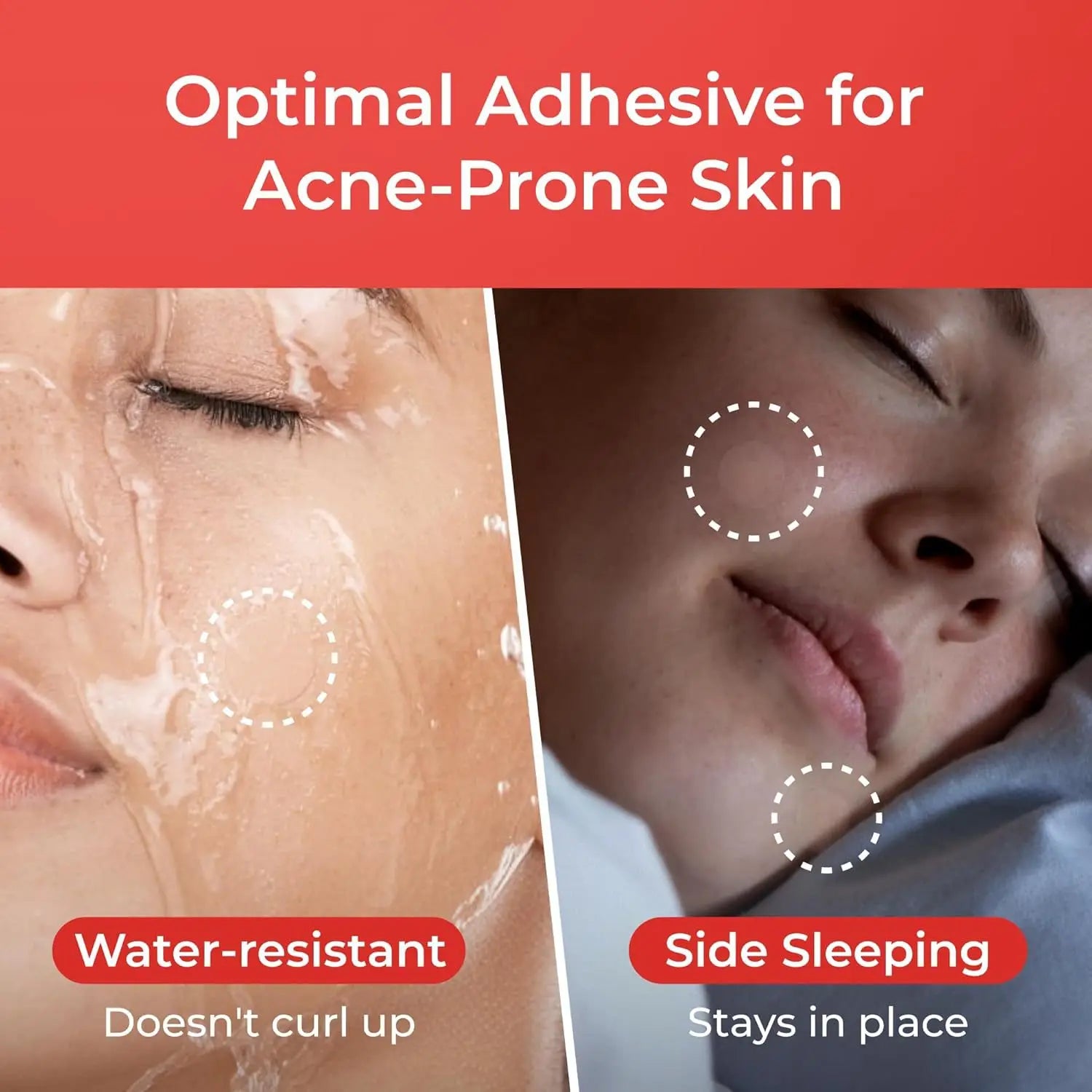 Hydrocolloid Pimple Patches for Fast Blemish Healing