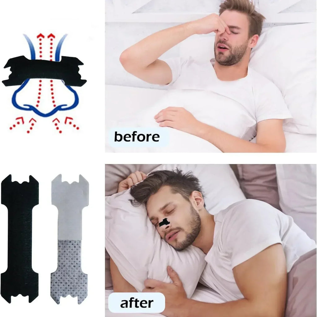 Anti-Snoring Breathable Nasal Strips for Better Sleep