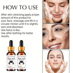 Brightening Kojic Acid Serum for Dark Spots and Even Skin Tone