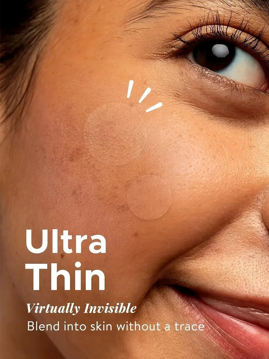 Invisible Hydrocolloid Acne Pimple Patches (360 Count)
