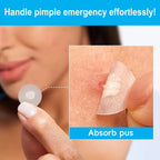 Invisible Hydrocolloid Acne Pimple Patches