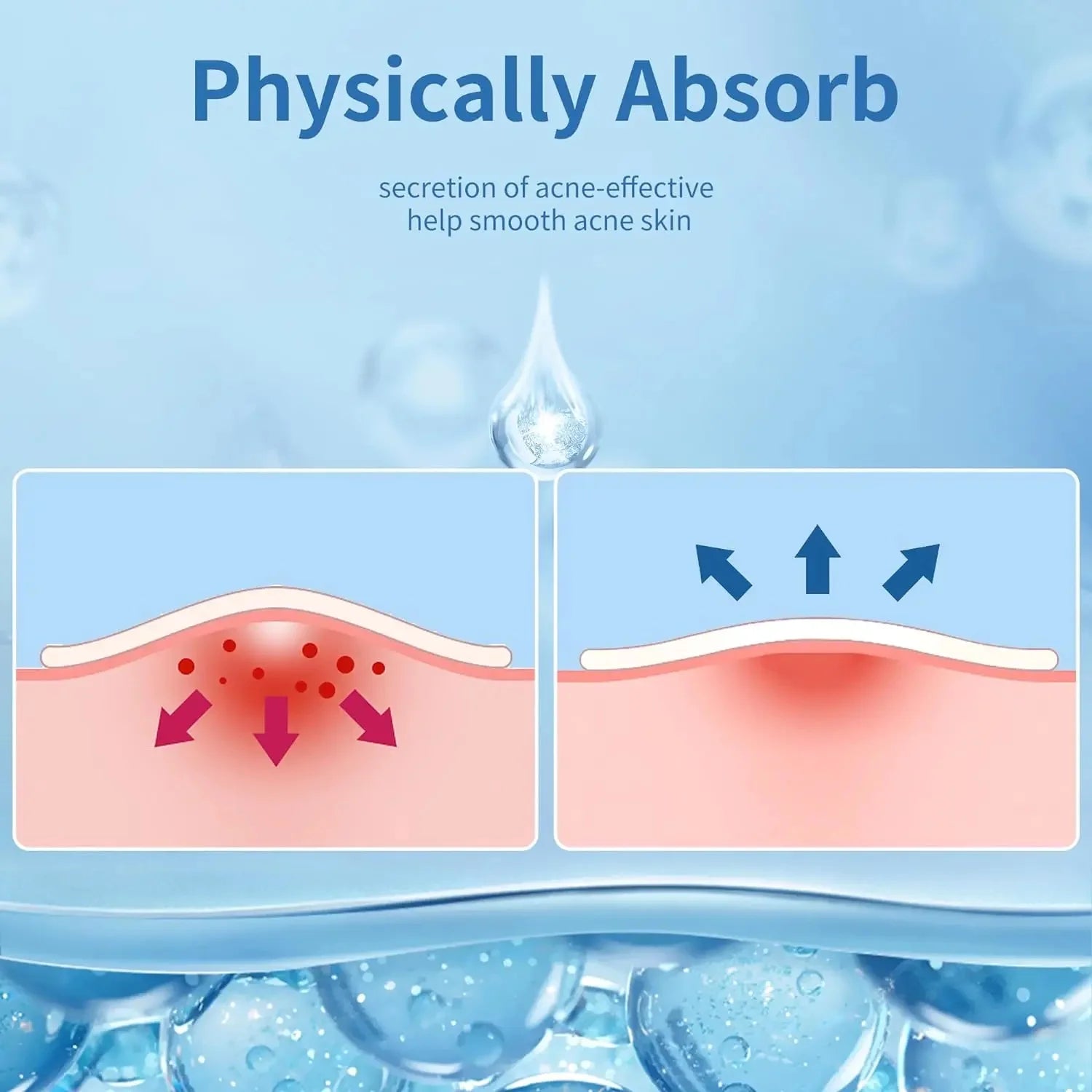 Invisible Acne Spot Treatment Patches