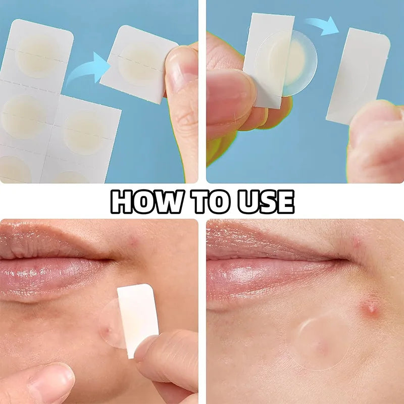 Invisible Hydrocolloid Acne Pimple Patches