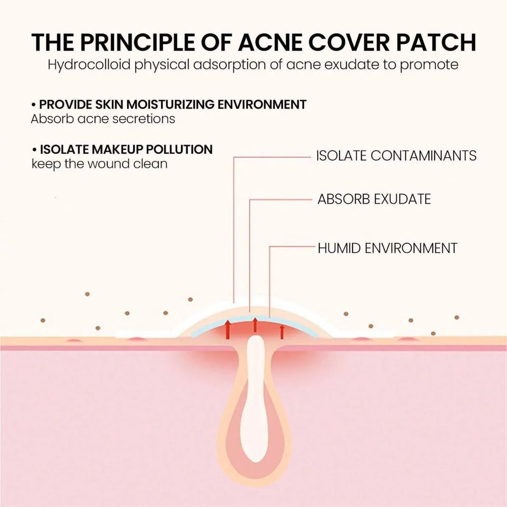 Star Shaped Hydrocolloid Acne Patches for Blemishes