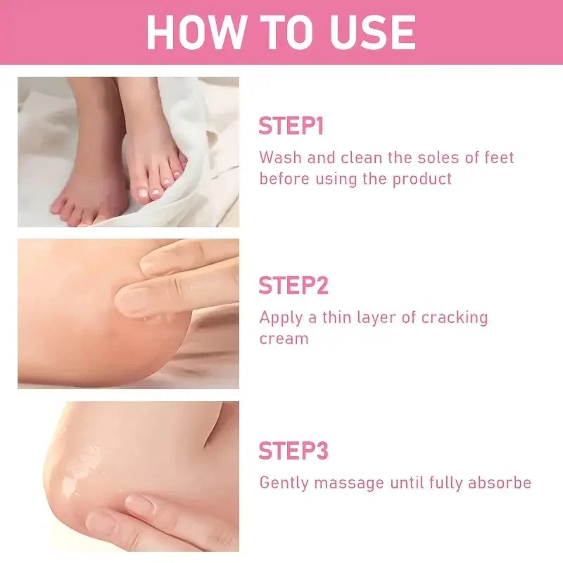 Intensive Urea Repair Cream for Cracked Heels and Dry Skin
