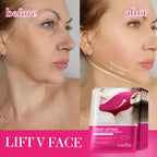 V-Shape Face Lifting Hydrogel Mask for Jawline Firming