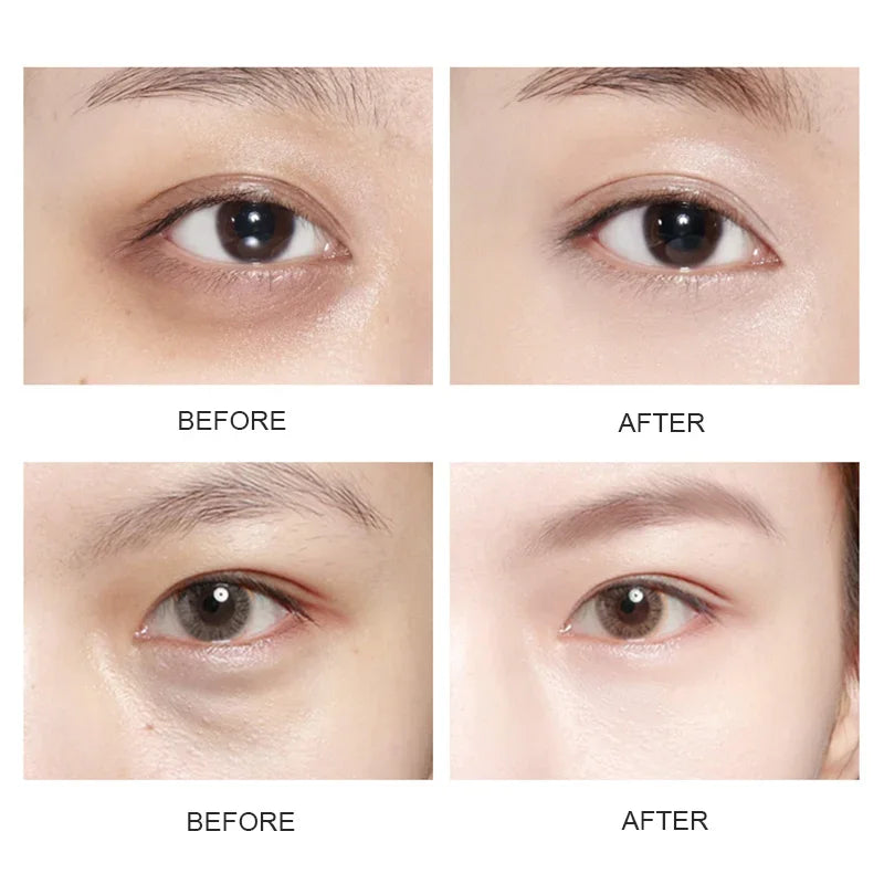 Gold Collagen Eye Masks for Dark Circles and Puffiness