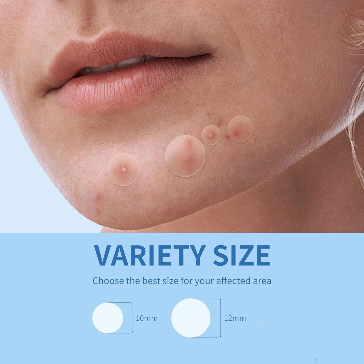 Invisible Hydrocolloid Acne Pimple Patches