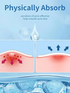 Invisible Hydrocolloid Acne Pimple Patches