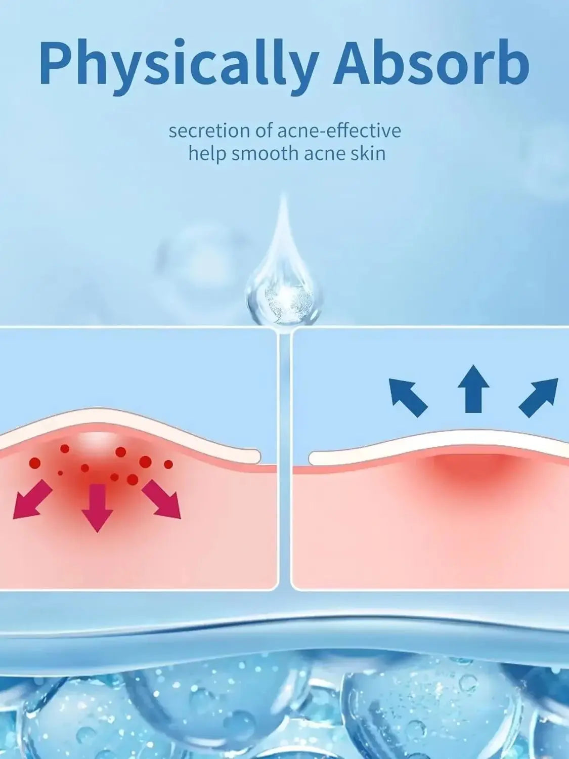 Invisible Hydrocolloid Acne Pimple Patches