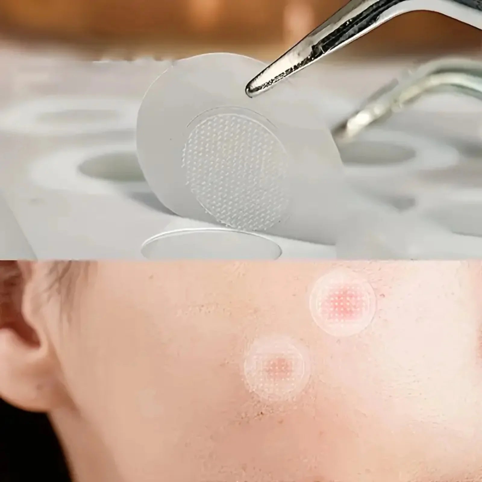 Hydrocolloid Acne Pimple Patches for Rapid Spot Treatment - 11