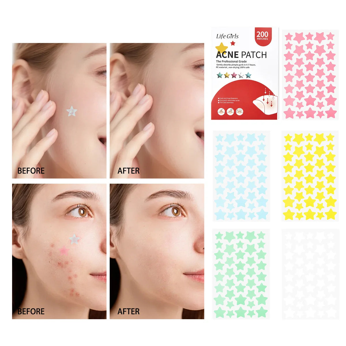 Star-Shaped Hydrocolloid Acne Patches for Clear Skin