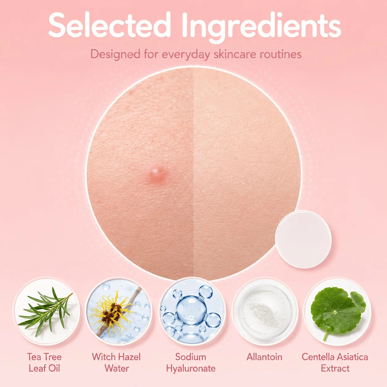 Invisible Hydrocolloid Acne Patch Set - 9