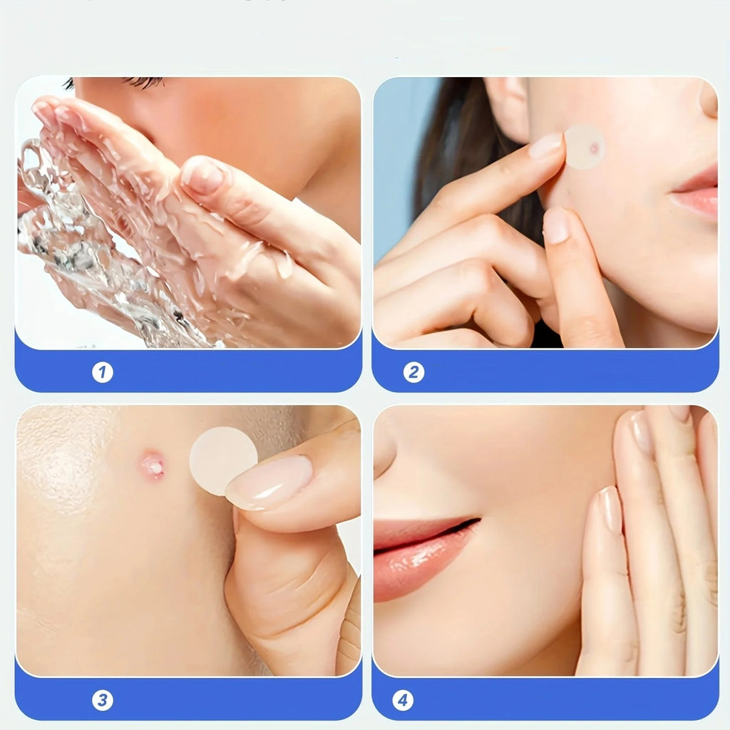 Cute Hydrocolloid Acne Pimple Patches