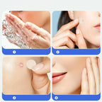 Cute Hydrocolloid Acne Pimple Patches