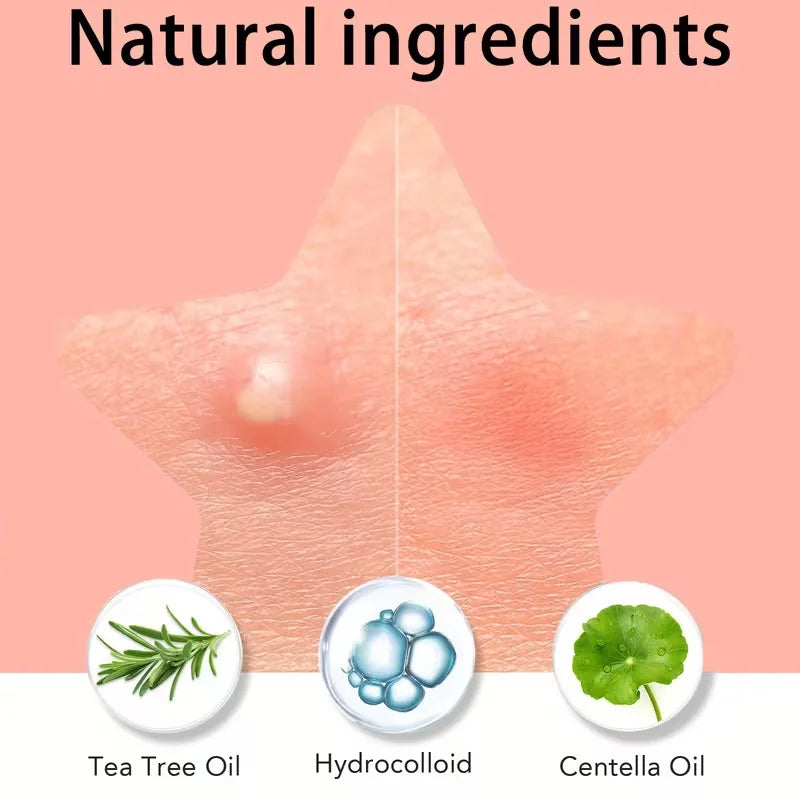 Colorful Hydrocolloid Pimple Patches for Blemish Treatment