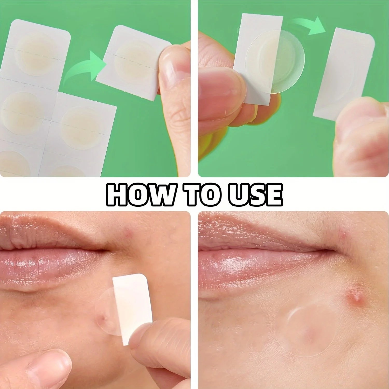 Invisible Hydrocolloid Acne Pimple Patches - 2