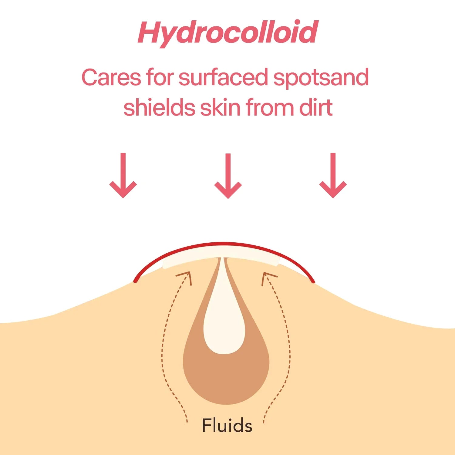 Colorful Heart Hydrocolloid Pimple Patches for Acne Treatment - 3