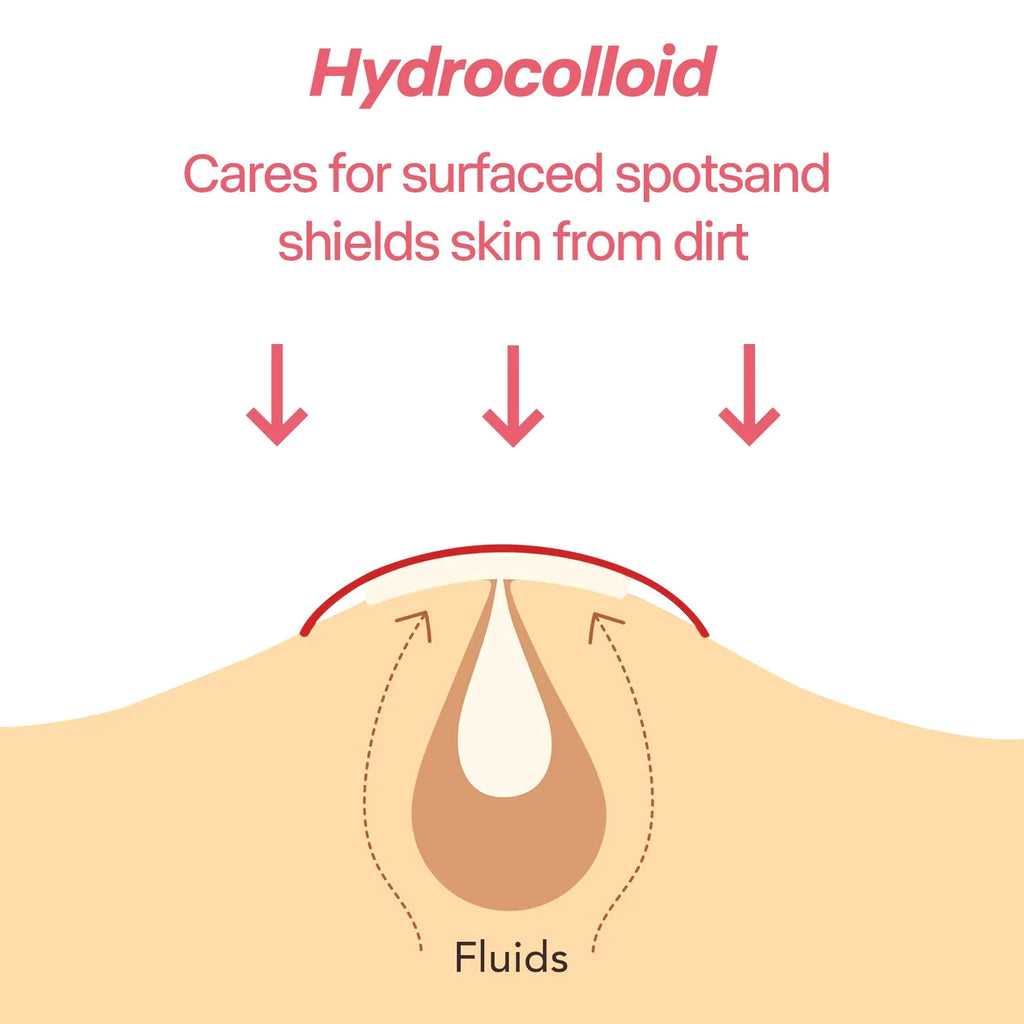 Colorful Heart Hydrocolloid Pimple Patches for Acne Treatment